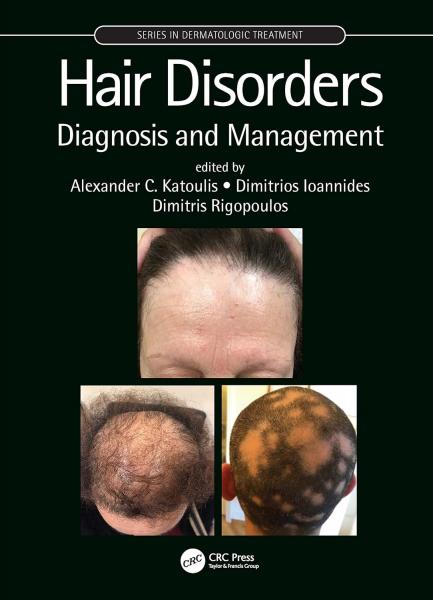Hair Disorders: Diagnosis and Management  2021 - پوست